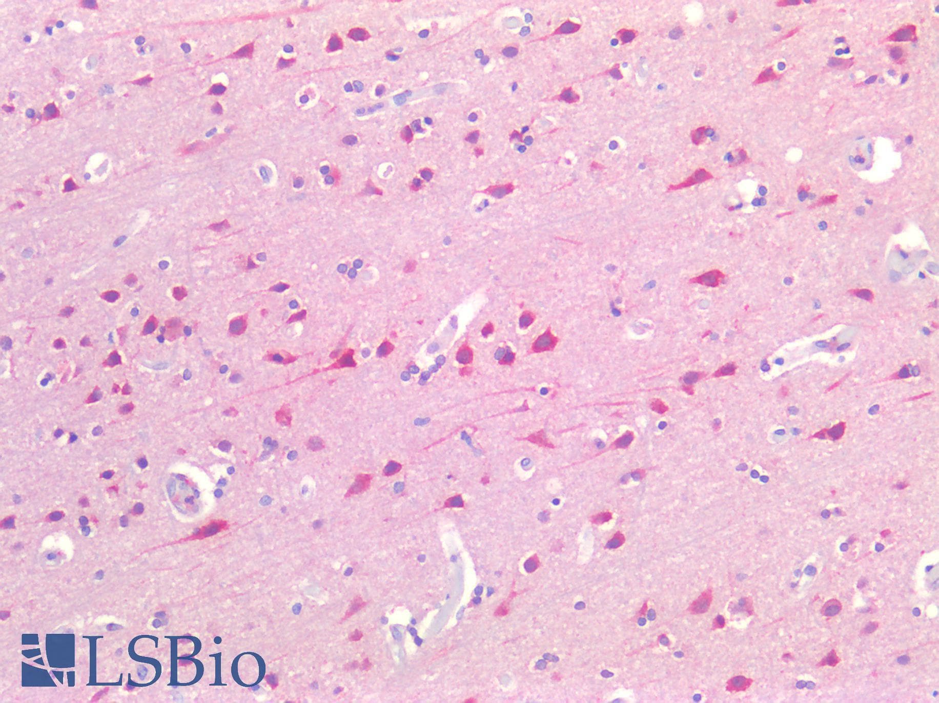 IHC-plus™ FOLH1 / PSMA Antibody