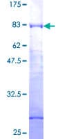 Human Requiem / DPF2 Protein (Recombinant GST)