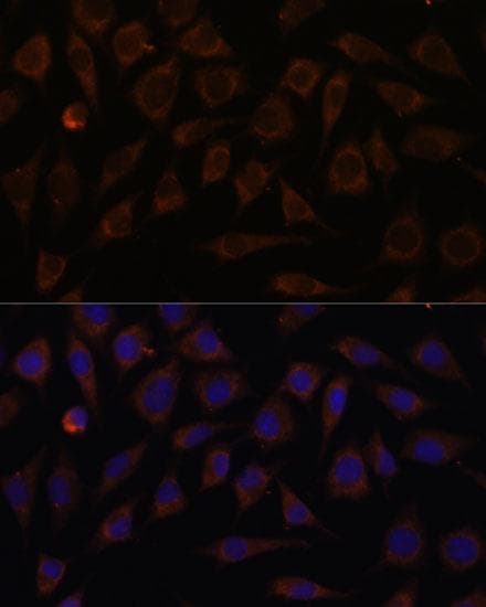 Polyclonal Rabbit anti-Human Villin-Like / VILL Antibody (IF)