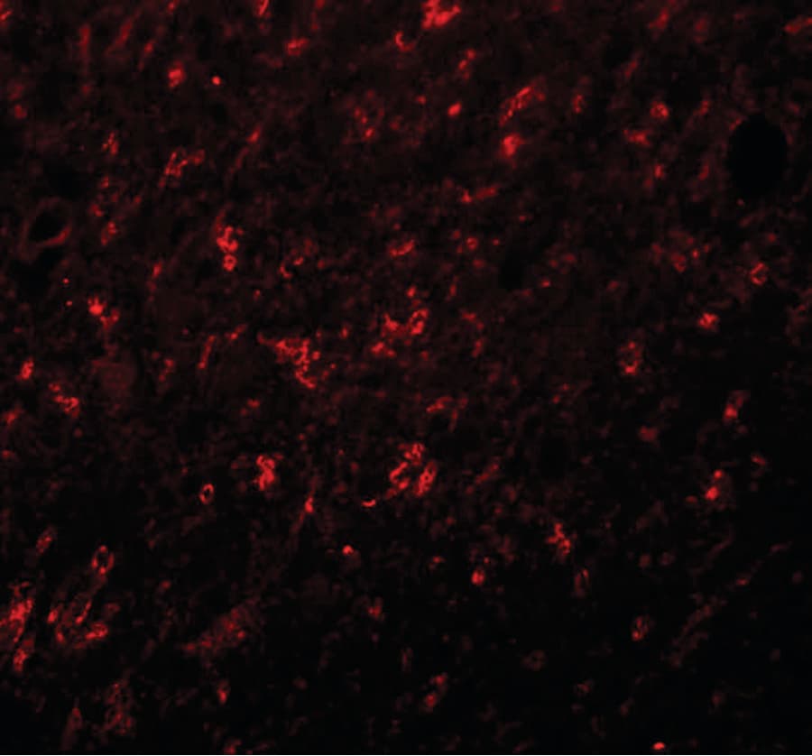 Polyclonal Rabbit anti-Human SYNGR4 / Synaptogyrin 4 Antibody (IHC, IF, WB)
