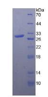 Rat TLR4 Protein (Recombinant His, N-Terminal)