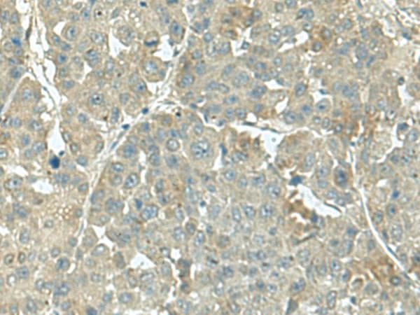 KRT36 / Keratin 36 / KRTHA6 Antibody