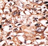 Polyclonal Rabbit anti-Human TNFRSF1A / TNFR1 Antibody (phospho-Ser274, IHC, WB)