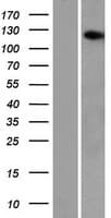AASDH / ACSF4 Protein (Over-Expression Lysate Myc-DDK (Flag))