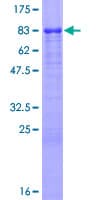Human VTN / Vitronectin Protein (Recombinant GST)
