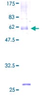Human MOG Protein (Recombinant GST)