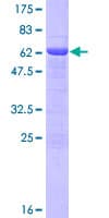 Human UPRT Protein (Recombinant GST)