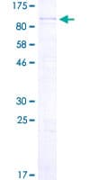 Human PPM1D / WIP1 Protein (Recombinant GST, N-terminus)