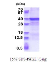 Human ZWINT Protein (Recombinant His)