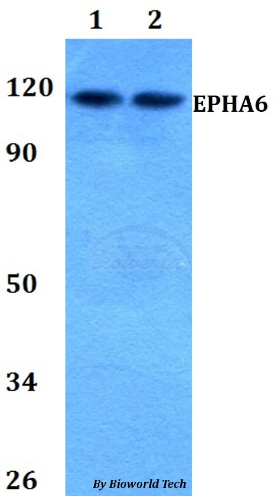 Polyclonal Rabbit anti-Human EPHA6 / EPH Receptor A6 Antibody (WB)