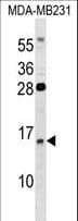 GUCA2B / Uroguanylin Antibody (aa69-97)
