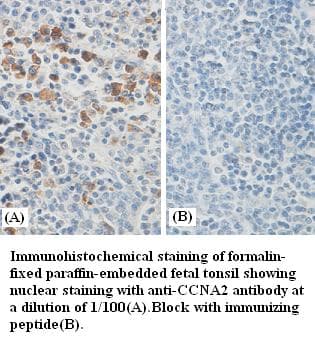 Polyclonal Rabbit anti-Human CCNA2 / Cyclin A2 Antibody (IHC, WB)