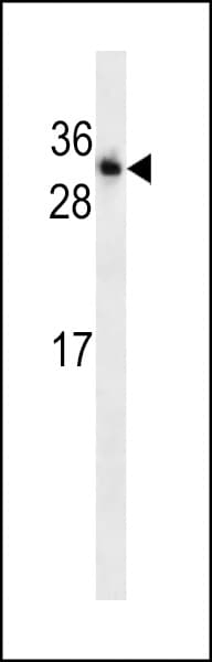 TNNI3 / Cardiac Troponin I Antibody (aa52-79)