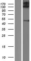 Human ZFYVE27 / Protrudin Protein (Over-Expression Lysate Myc-DDK (Flag))