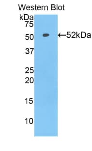 SLC27A5 / BACS Antibody (aa471-689, PE)