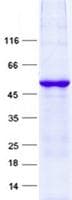 Human TSSK6 Protein (Recombinant GST, N-terminus + His, C-terminus)