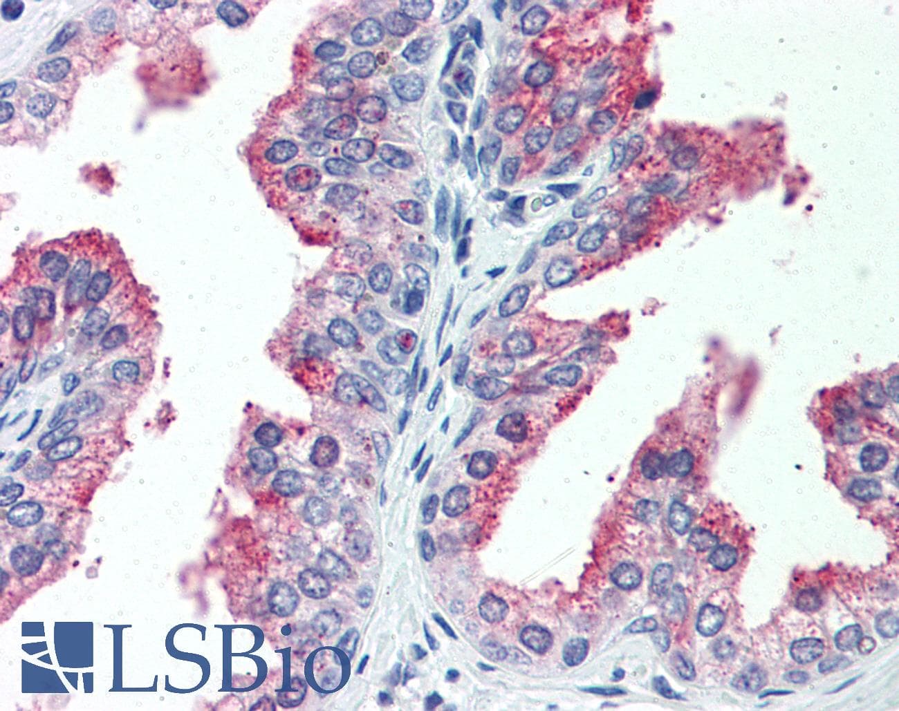 IHC-plus™ Polyclonal Rabbit anti-Human CDCP1 Antibody (Extracellular Domain, IHC)