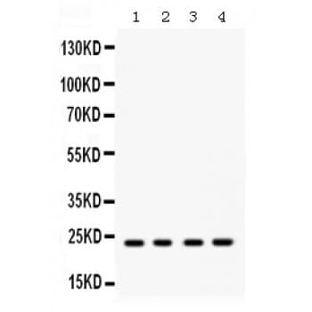 RAB9A / RAB9 Antibody (aa156-193)