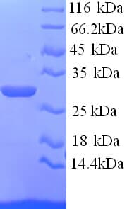 Mouse ASGR1 / ASGPR Protein (Recombinant His)