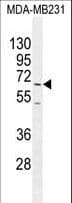 Polyclonal Rabbit anti-Human FUT8 Antibody (aa329-357, IHC, WB)
