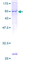 Human ALK3 / BMPR1A Protein (Recombinant GST)