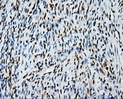 Monoclonal Mouse anti-Human TLDC1 / KIAA1609 Antibody (clone OTI5D9, IHC, IF, WB)