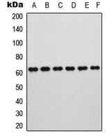 RORA / ROR Alpha Antibody (N-Terminus)