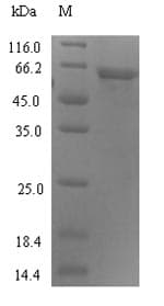 Human C4orf29 Protein (Recombinant 6His-SUMO, N-terminus)