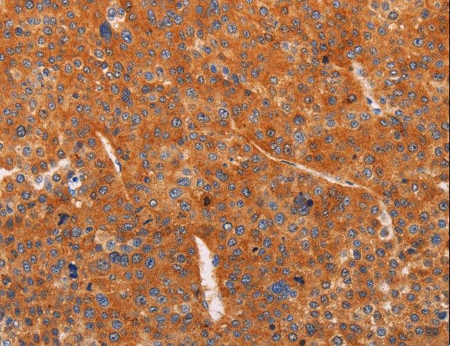ADCY1 / Adenylate Cyclase 1 Antibody