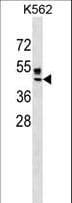 ZNRF4 Antibody (aa111-138)