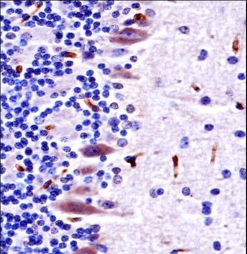 Polyclonal Rabbit anti-Human MLK4 / KIAA1804 Antibody (aa566-593, IHC, WB)
