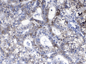 Polyclonal Rabbit anti-Human ERBB2 / HER2 Antibody (IHC, WB)