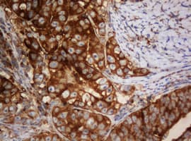 PAI-RBP1 / SERBP1 Antibody (aa1-262, clone OTI1E7)
