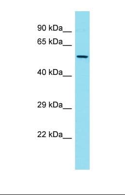 FKBP5 / FKBP51 Antibody (aa208-257)