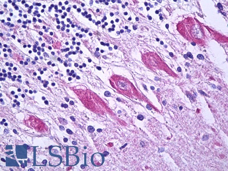 DNM1L / DRP1 Antibody (Internal, Biotin)