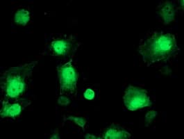 Monoclonal Mouse anti-Human AIPL1 Antibody (clone OTI1B2, IF, WB)