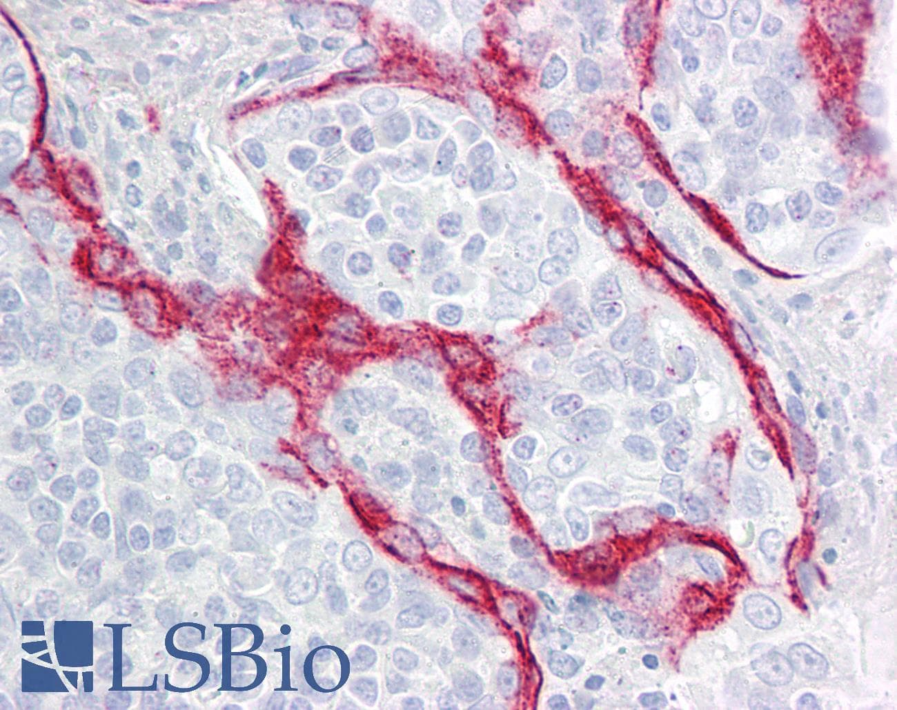 IHC-plus™ Polyclonal Rabbit anti-Human PARP3 Antibody (aa10-59, IHC)