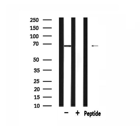 GRK5 Antibody