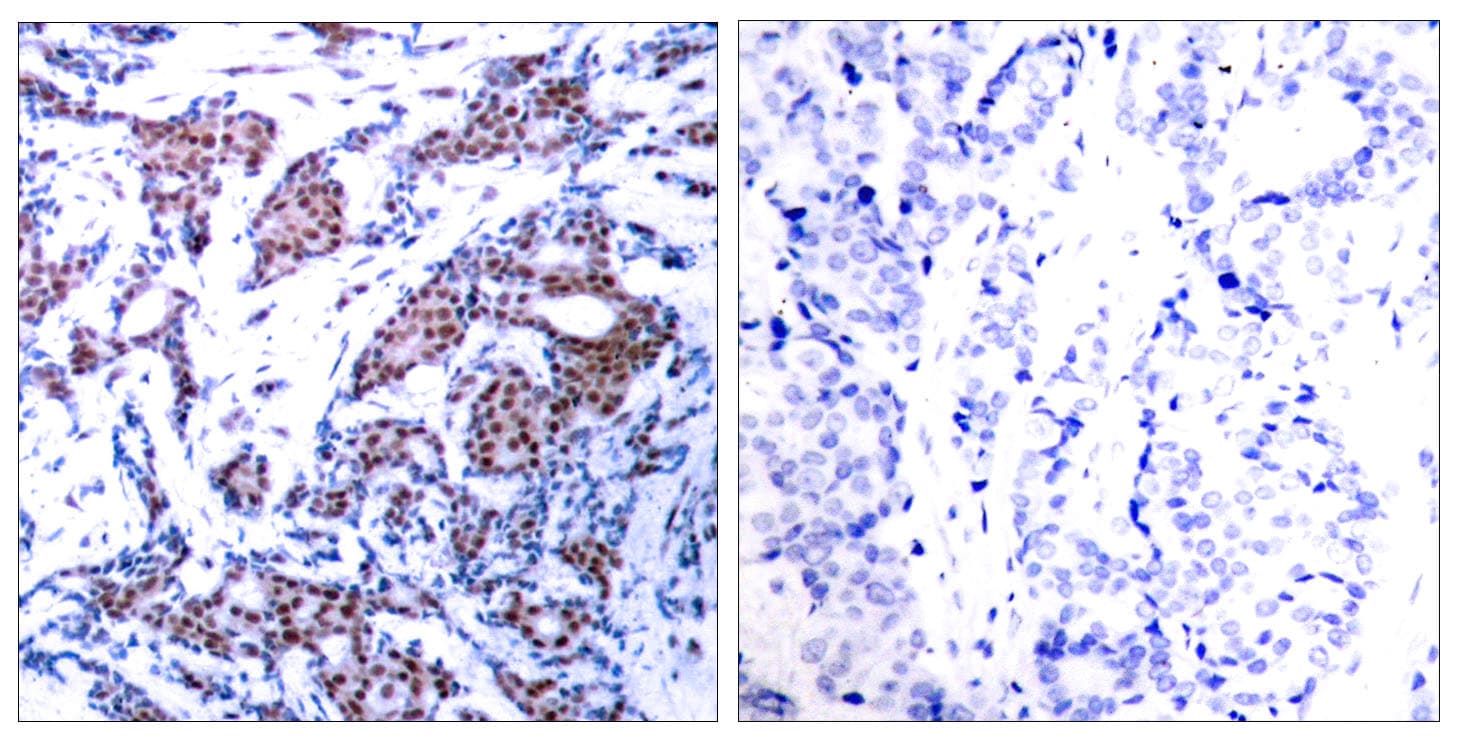 Polyclonal Rabbit anti-Human JUN / c-Jun Antibody (phospho-Ser73, IHC, WB)