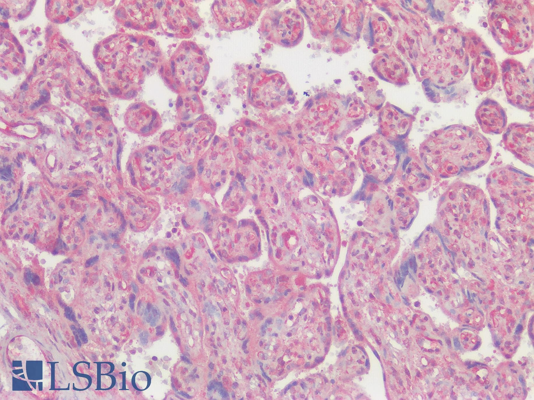 IHC-plus™ Polyclonal Rabbit anti-Human SLC29A1 / ENT1 Antibody (Internal, IHC)