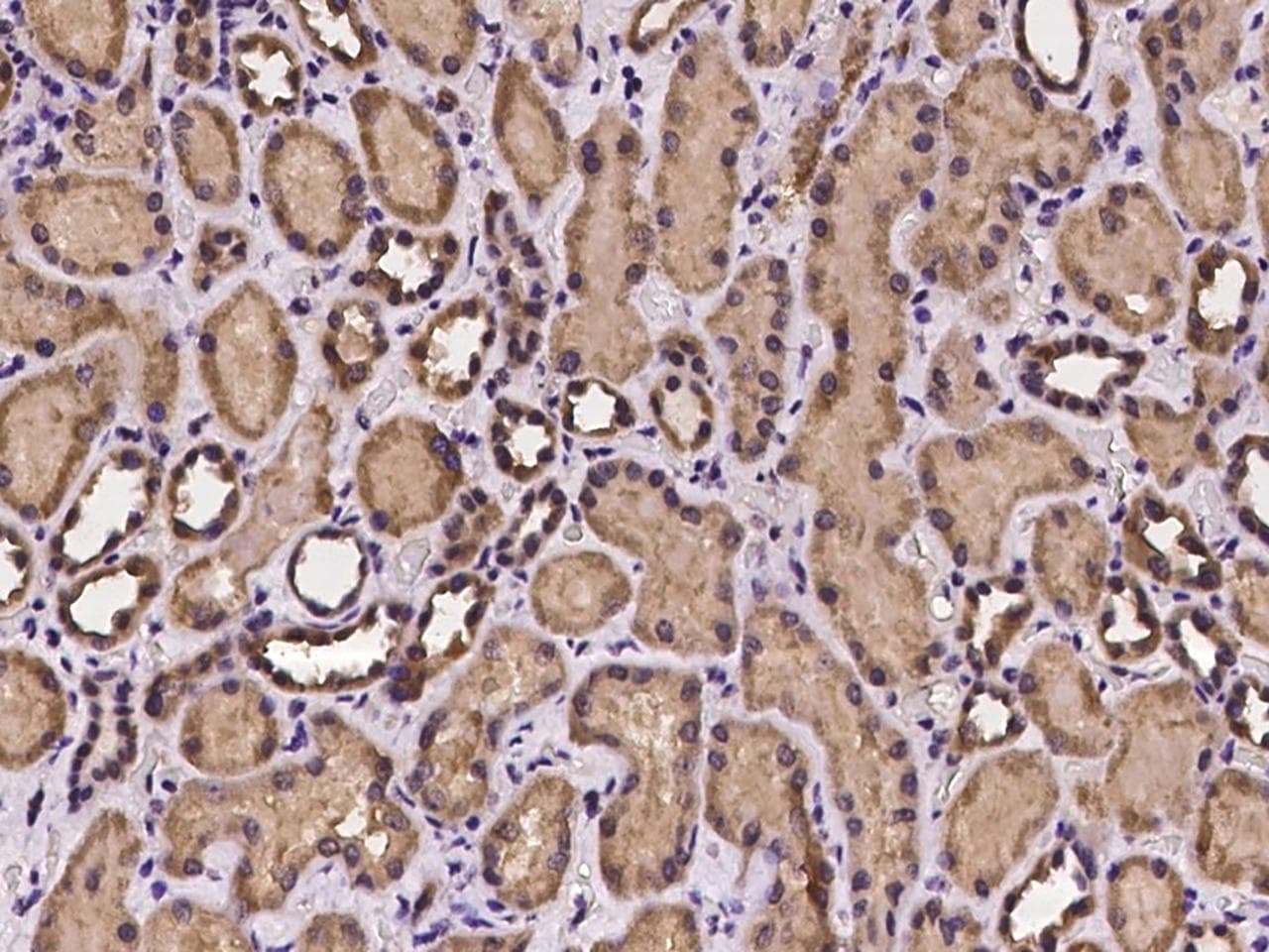 C-TAK1 / MARK3 Antibody