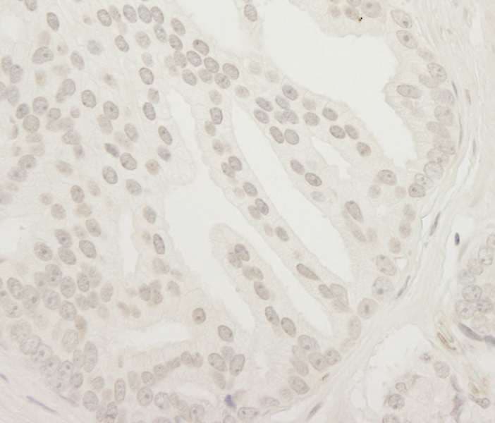 Polyclonal Rabbit anti-Human USP37 Antibody (aa930-C-term, IHC)