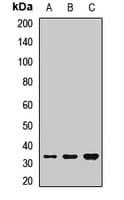 PHOX2B Antibody