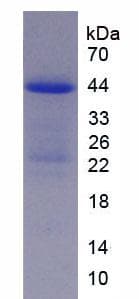 Mouse TSLP Protein (Recombinant His-GST)