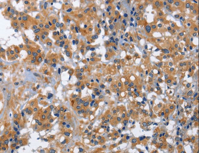IL2RB / CD122 Antibody