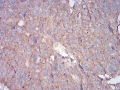 Monoclonal Mouse anti-Human RALA / RAL Antibody (clone 4G8C7, IHC, WB)