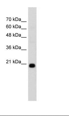 FBXO25 Antibody (C-Terminus)