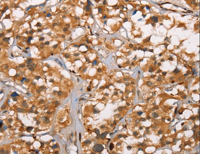 DICER1 / Dicer Antibody