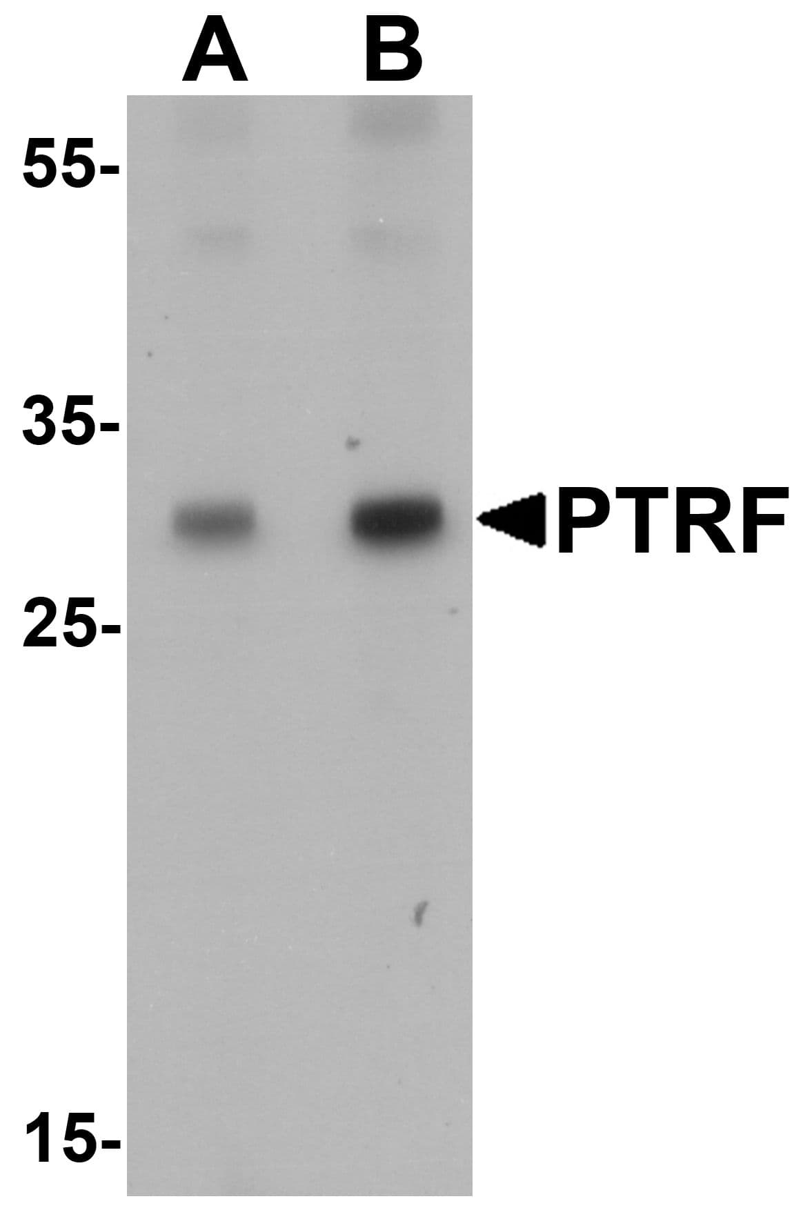 IHC-plus™ Polyclonal Rabbit anti-Human SDR / SDPR Antibody (IHC, IF, WB)