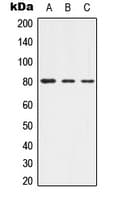 Polyclonal Rabbit anti-Human ADD1 / Adducin Alpha Antibody (phospho-Thr445, IHC, WB)